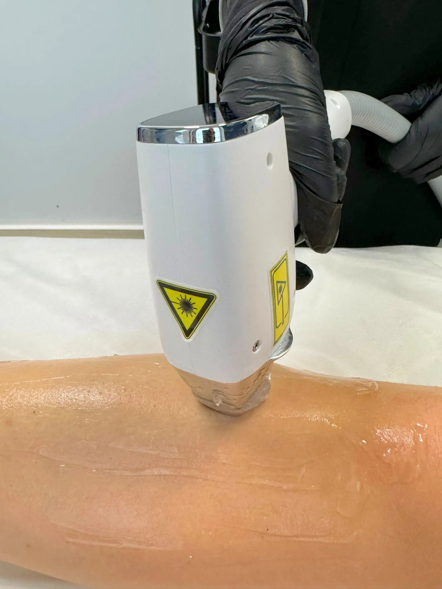 Applicateur Ténor sur jambe — séance laser diode