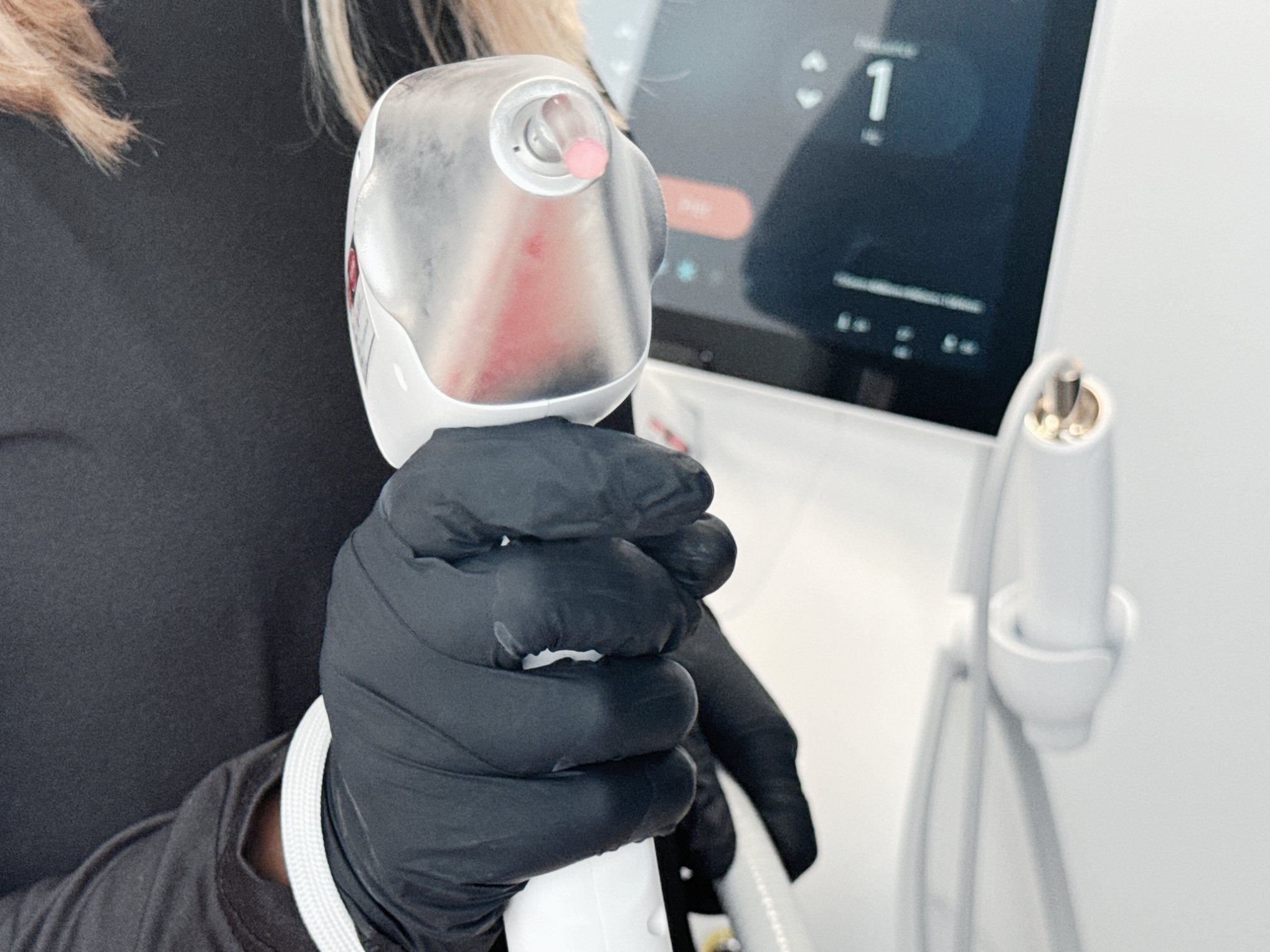 Architecture interne tête laser LIMO Ténor brevetée