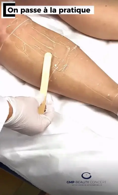 On passe à la pratique — formation laser Ténor