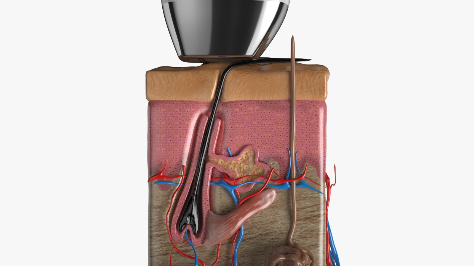 Mécanisme laser diode sur peau