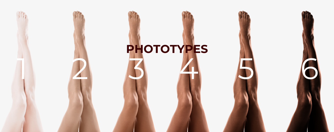 les différents phototypes pour l'epilation définitive